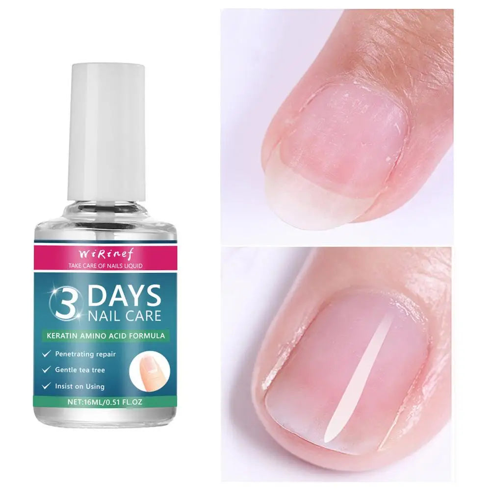 Nail Care Liquid Rapid Nail Revitalization Nourishing Liquid Rejuvenate Damaged Nails Soothing Tea Tree Care