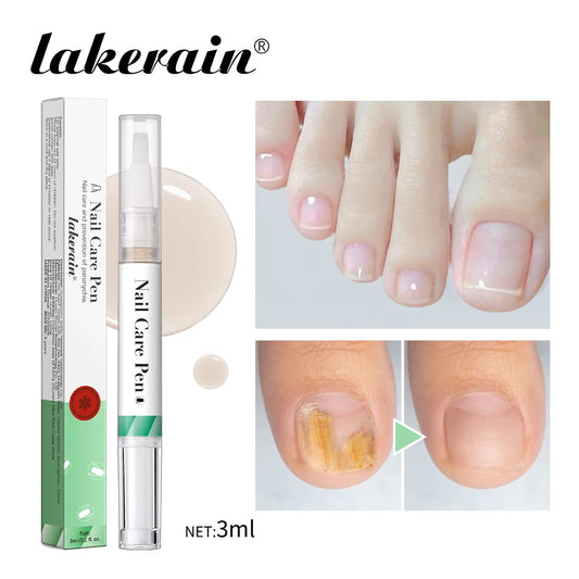 1/2pc Nail Care Mild Ingredients Prevent Damaged Nail Bed Treat Onychomycosis Nail Repair Pen For Nail Beauty Health Care Tool