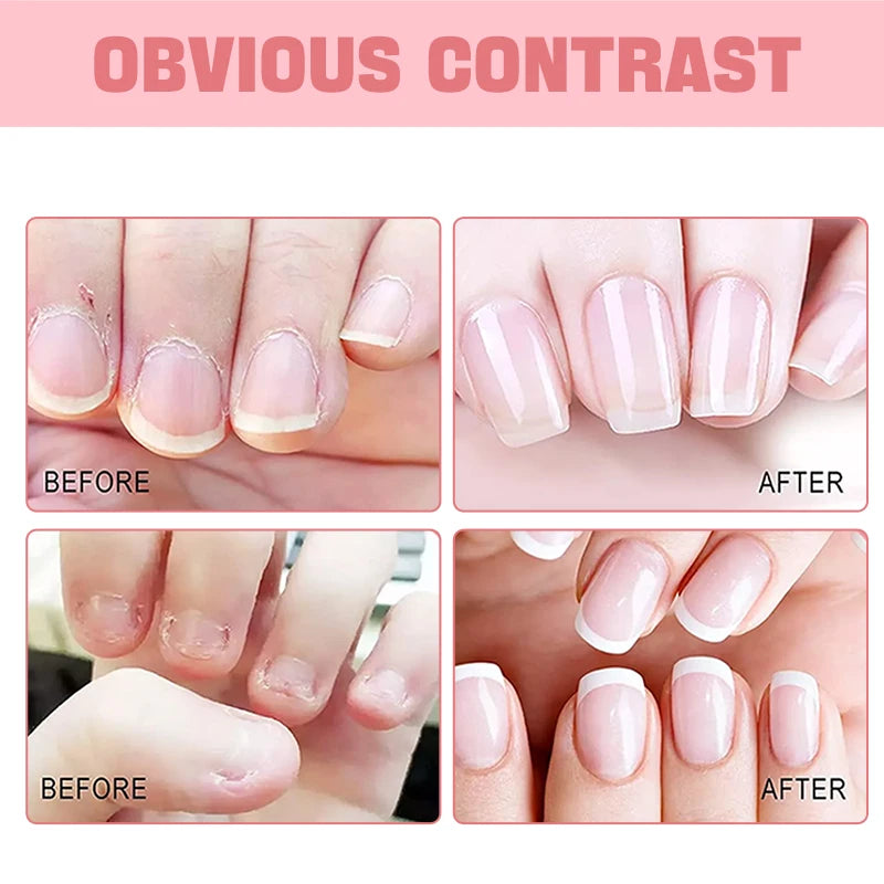 Nail and Cuticle Oil Nail Care, Moisturizing, Strengthening,Nail Oil Cuticle, Hydrating- For Stronger, Healthier Nails.