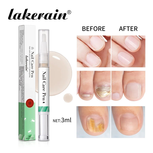 Nail Care Pen Nourish and Moisturize Nails Prevent Fungal Infections Improve Appearance Flat Brush Head Design Daily Nail Care