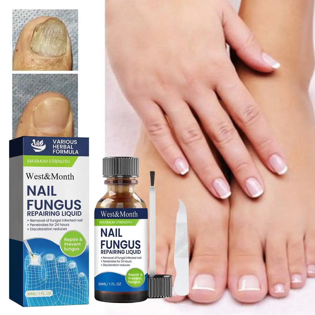 Nail Fungus Care Solution Anti-Infection Onychomycosis Repair Damaged Cracked Hand Foot Nail Manicureed Health Care Essence
