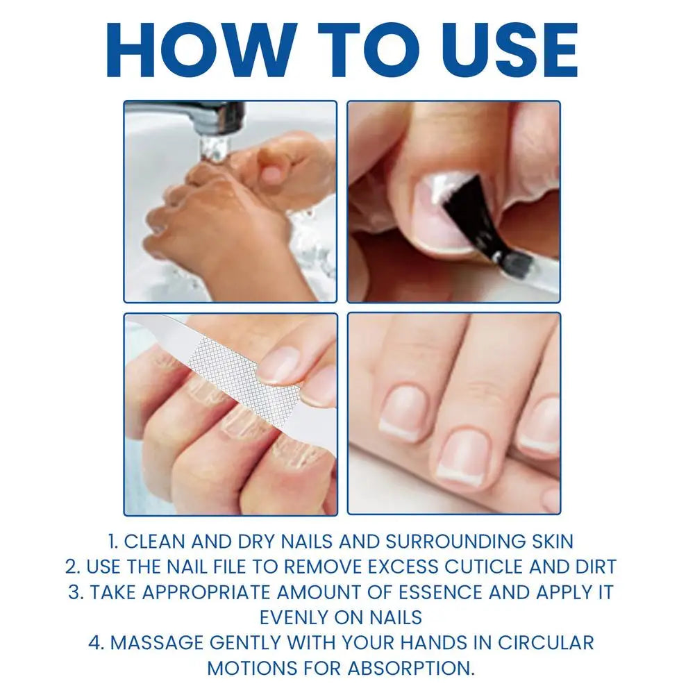 Nail Fungus Care Solution Anti-Infection Onychomycosis Repair Damaged Cracked Hand Foot Nail Manicureed Health Care Essence