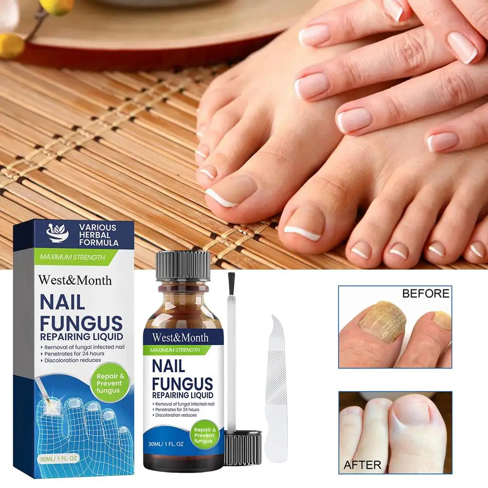 Nail Fungus Care Solution Anti-Infection Onychomycosis Repair Damaged Cracked Hand Foot Nail Manicureed Health Care Essence