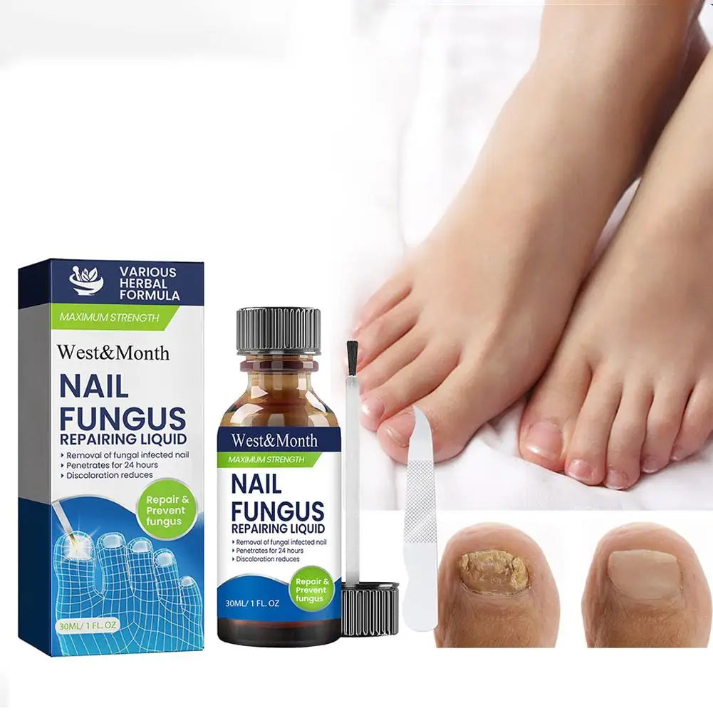 Nail Fungus Care Solution Anti-Infection Onychomycosis Repair Damaged Cracked Hand Foot Nail Manicureed Health Care Essence