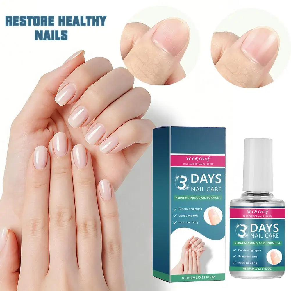 Nail Care Liquid Rapid Nail Revitalization Nourishing Liquid Rejuvenate Damaged Nails Soothing Tea Tree Care