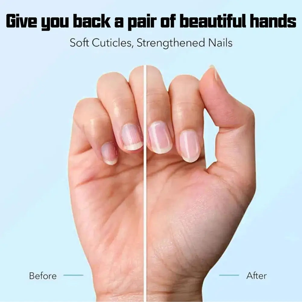 Nail Care Liquid Rapid Nail Revitalization Nourishing Liquid Rejuvenate Damaged Nails Soothing Tea Tree Care